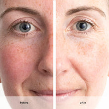 Load image into Gallery viewer, Anew Renewal Power Serum Protinol