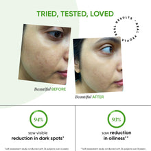 Load image into Gallery viewer, 10% Niacinamide Cica Face Serum with 3% Tranexamic for Dark Spots & Acne Scars